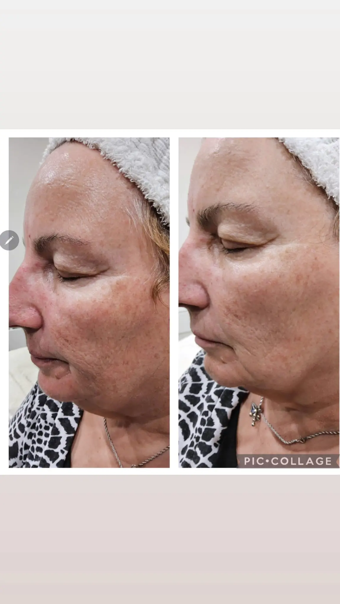 Ageing and rejuvenation before and after