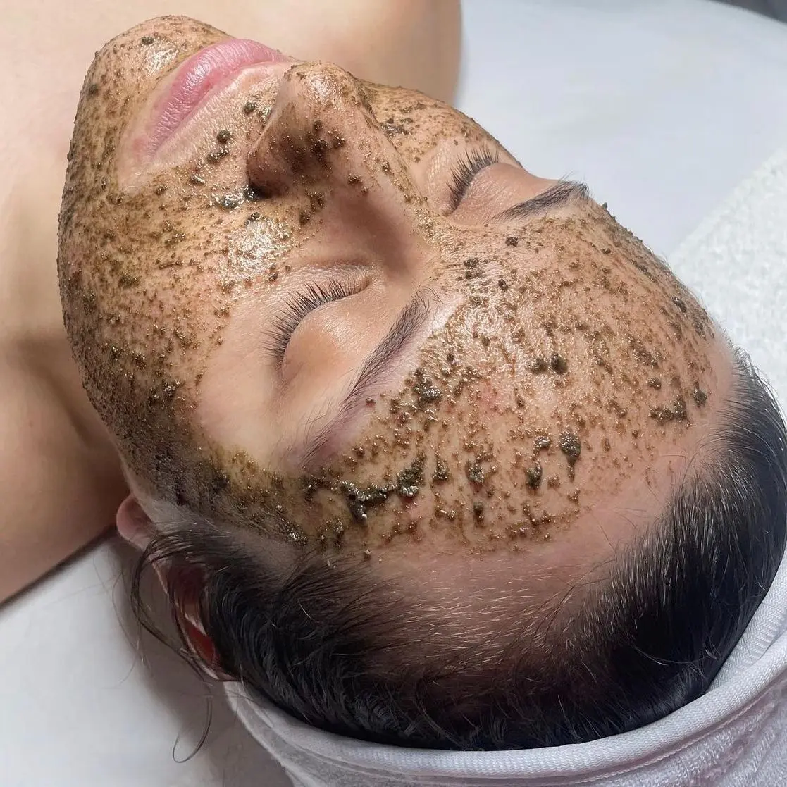 Bio Spicules treatment