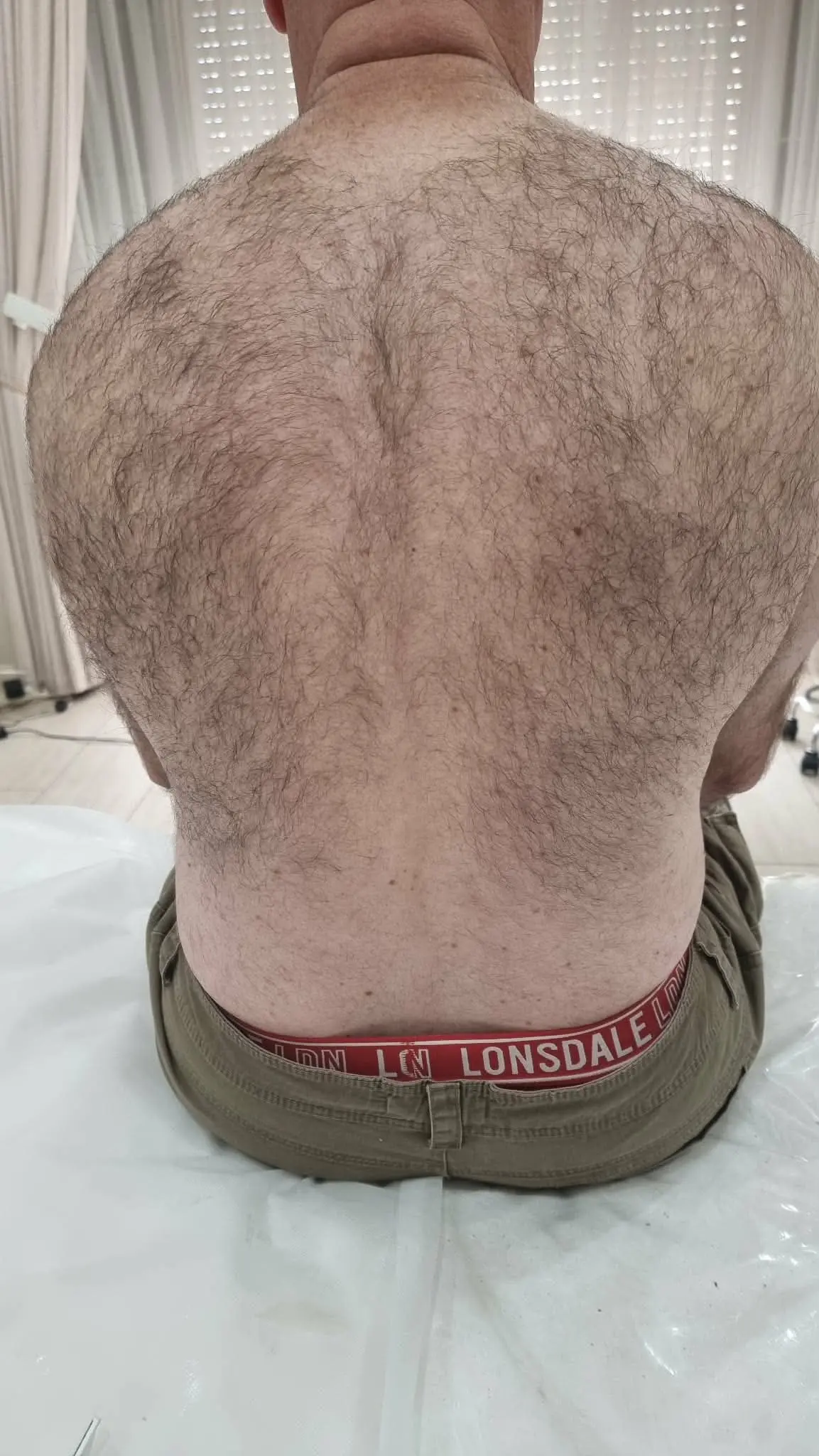 Back hair before SHR